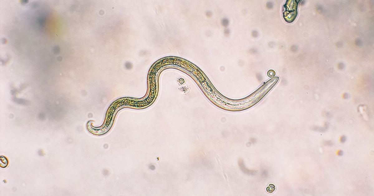 Microscope photograph of a parasitic worm